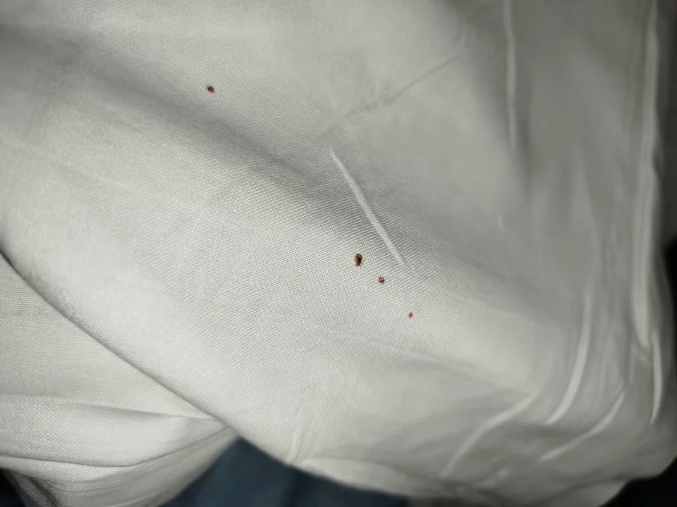 Un insecte et de petites traces rouges visibles sur du linge blanc, selon la photo transmise par la mère.